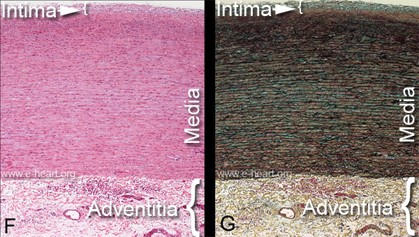 Aorta Histology